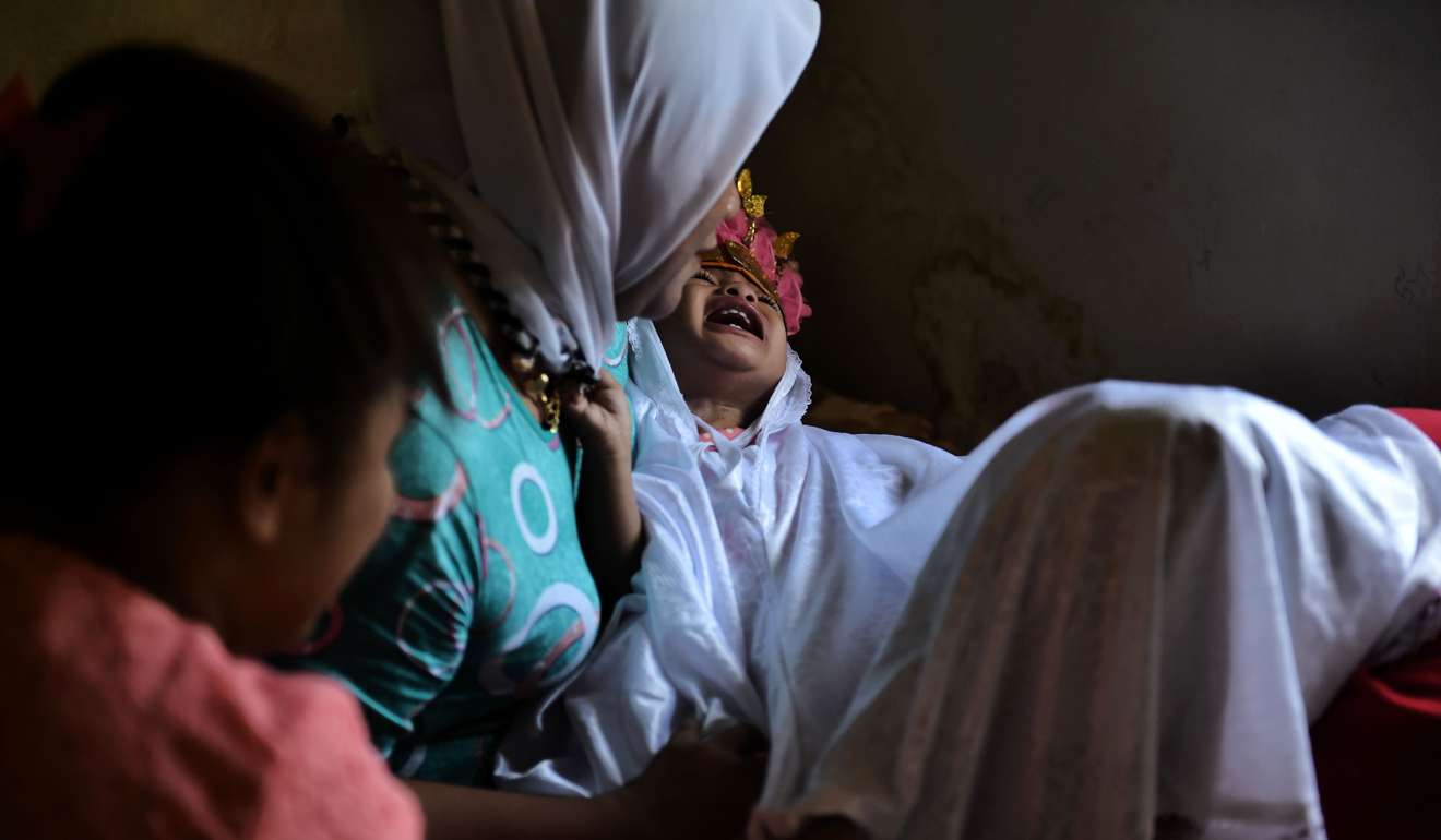 Toddler Salsa Djafar cries as a traditional healer conducts a circumcision in Gorontalo. Photo: AFP