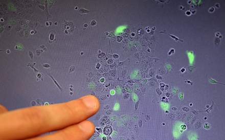 Associate scientist Stuart Sievers, Ph.D., points to a screen that displays the view from a microscope. Image: Los Angeles Times