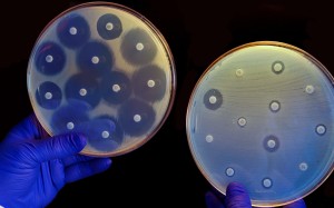 The plate on the left contains bacteria that are susceptible to antibiotics while the one on the right contains antibiotic-resistant bacteria. Picture: Alamy