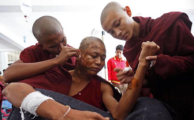 A Buddhist monk receives treatment after police fired water cannon and tear gas during a crackdown on villagers in Monywa, Myanmar, on Thursday. Photo: AFP