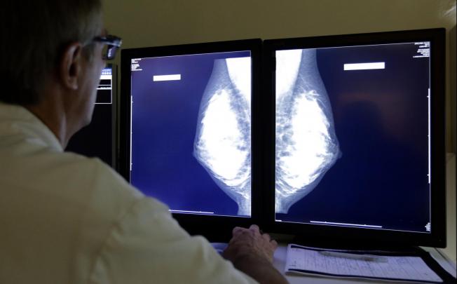 A radiologist examines breast X-rays. Photo: Reuters