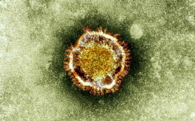 An electron microscope image of a coronavirus, part of a family of viruses that cause ailments including the common cold and SARS. Photo: AP