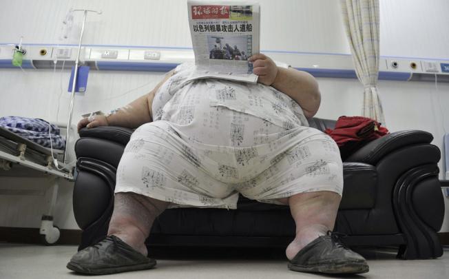 Sorting obesity myths from fact. Photo: Reuters