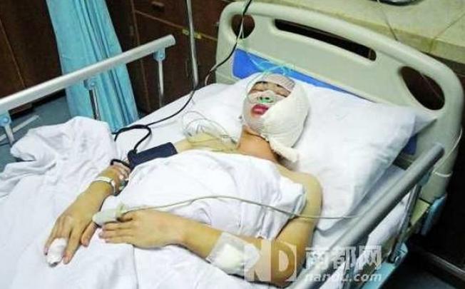 Photo from nandu.com, of the injured chengguan official in hospital. 
