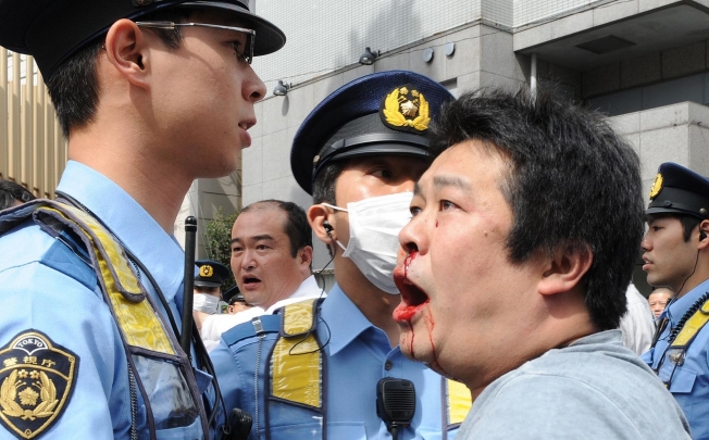 A Korean victim of a nationalist group protest. Photo: AFP