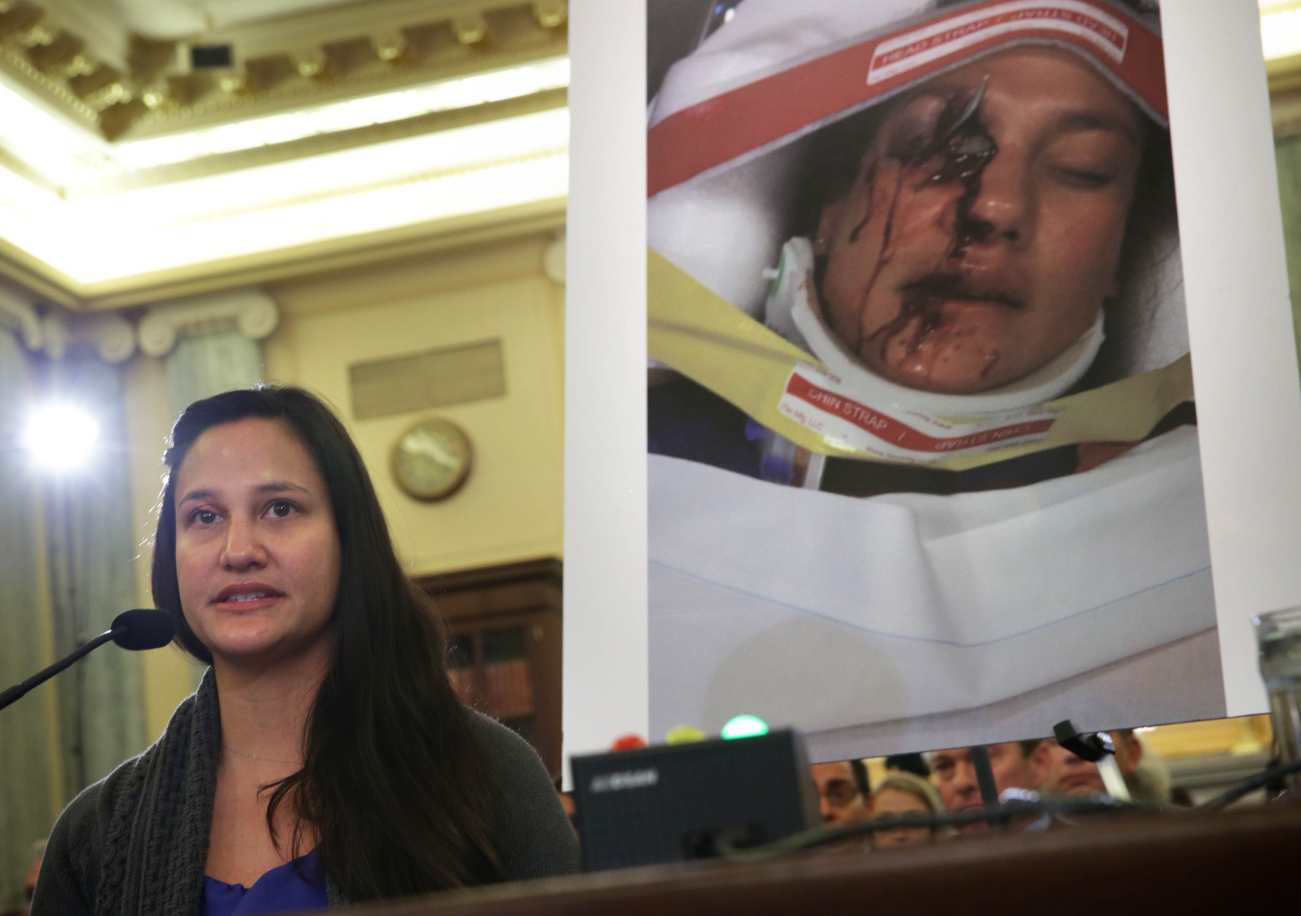 Florida citizen Stephanie Erdman, who was seriously injured by the airbag explosion in her Honda Civic last year, testifies during a hearing before the Senate Commerce, Science and Transportation Committee. Photo: AFP