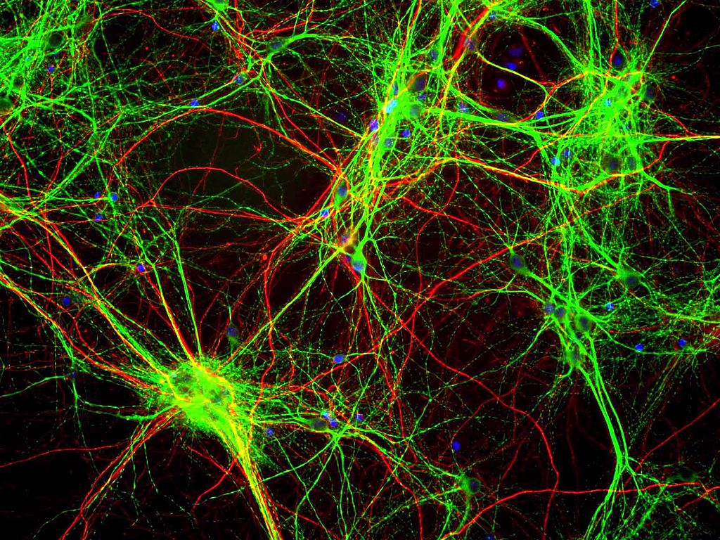 Layers of nerve cells in the retina. Photo: Flickr/NIH Image Gallery