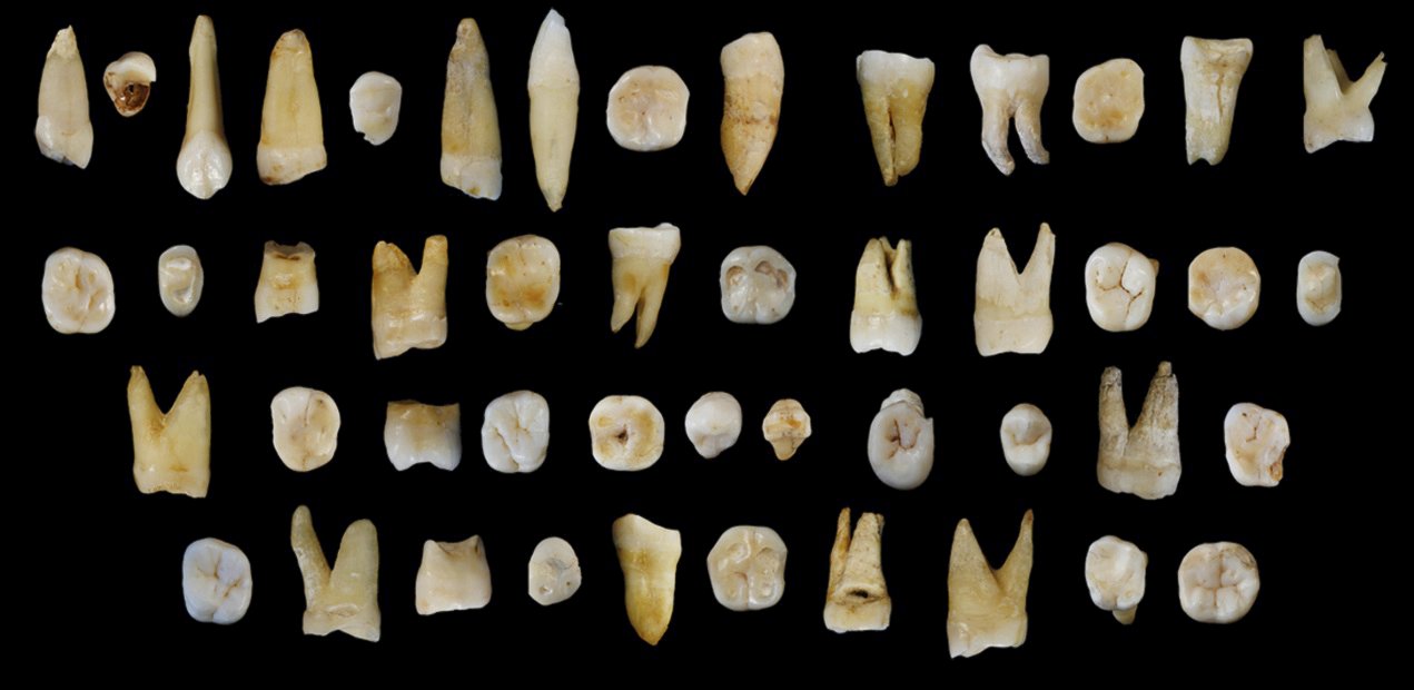 Forty-seven human teeth found in the Fuyan Cave in Hunan Province in China are pictured in this undated handout photo obtained by Reuters October 14, 2015. The trove of fossil human teeth from a cave in southern China is rewriting the history of the early migration of our species out of Africa, indicating Homo sapiens trekked into Asia far earlier than previously known and much earlier than into Europe. Scientists on Wednesday announced the discovery of teeth between 80,000 and 120,000 years old that they say provide the earliest evidence of fully modern humans outside Africa. REUTERS/S. Xing and X-J. Wu/Handout via ReutersATTENTION EDITORS - THIS PICTURE WAS PROVIDED BY A THIRD PARTY. REUTERS IS UNABLE TO INDEPENDENTLY VERIFY THE AUTHENTICITY, CONTENT, LOCATION OR DATE OF THIS IMAGE. FOR EDITORIAL USE ONLY. NOT FOR SALE FOR MARKETING OR ADVERTISING CAMPAIGNS. THIS PICTURE IS DISTRIBUTED EXACTLY AS RECEIVED BY REUTERS, AS A SERVICE TO CLIENTS. NO SALES. NO COMMERCIAL USE. TPX IMAGES OF