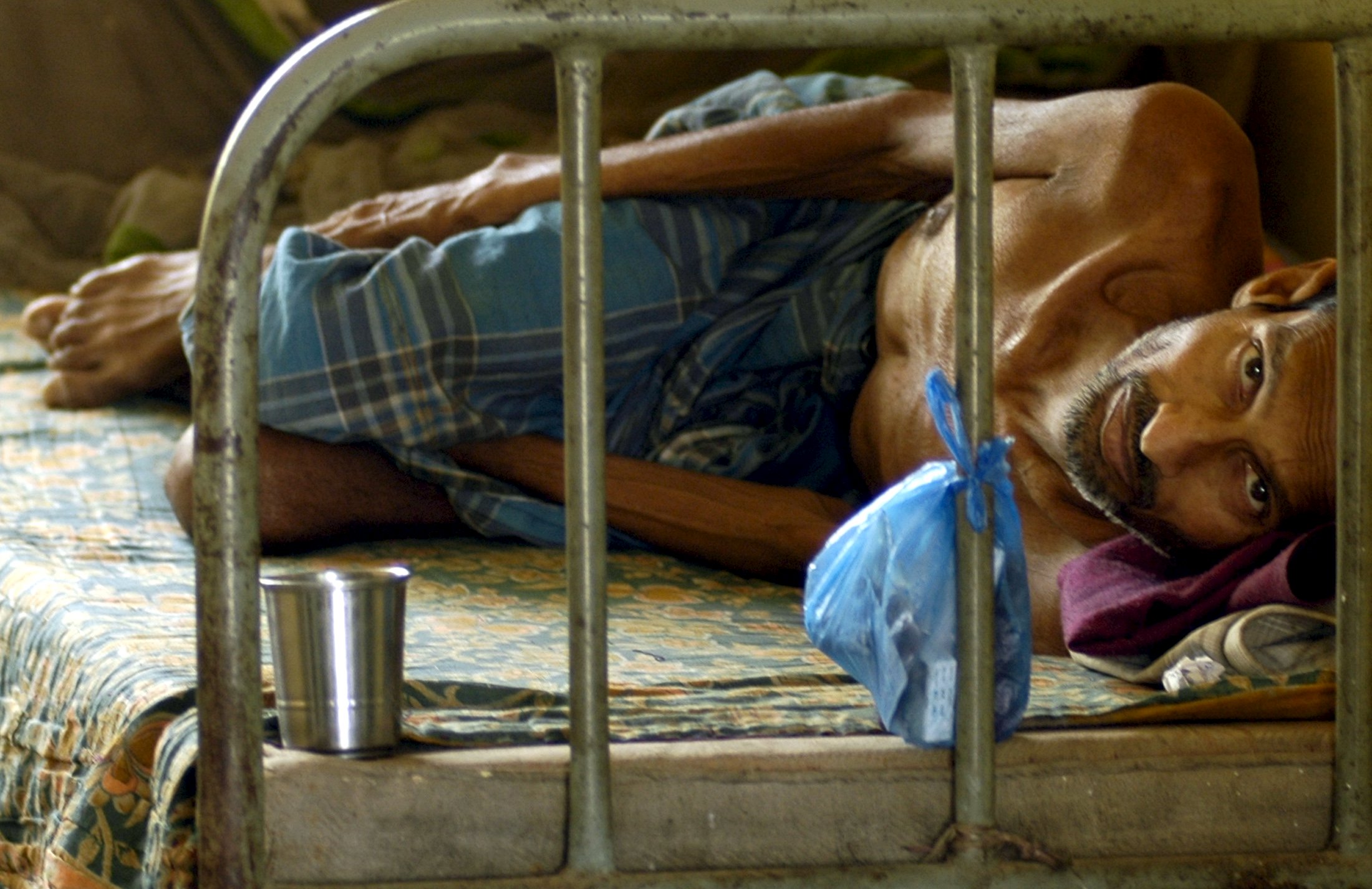 A patient suffering from Tuberculosis rests inside a hospital in Agartala, capital of India's northeastern state of Tripura, in this March 24, 2009 file photo. REUTERS/Jayanta Dey/Files