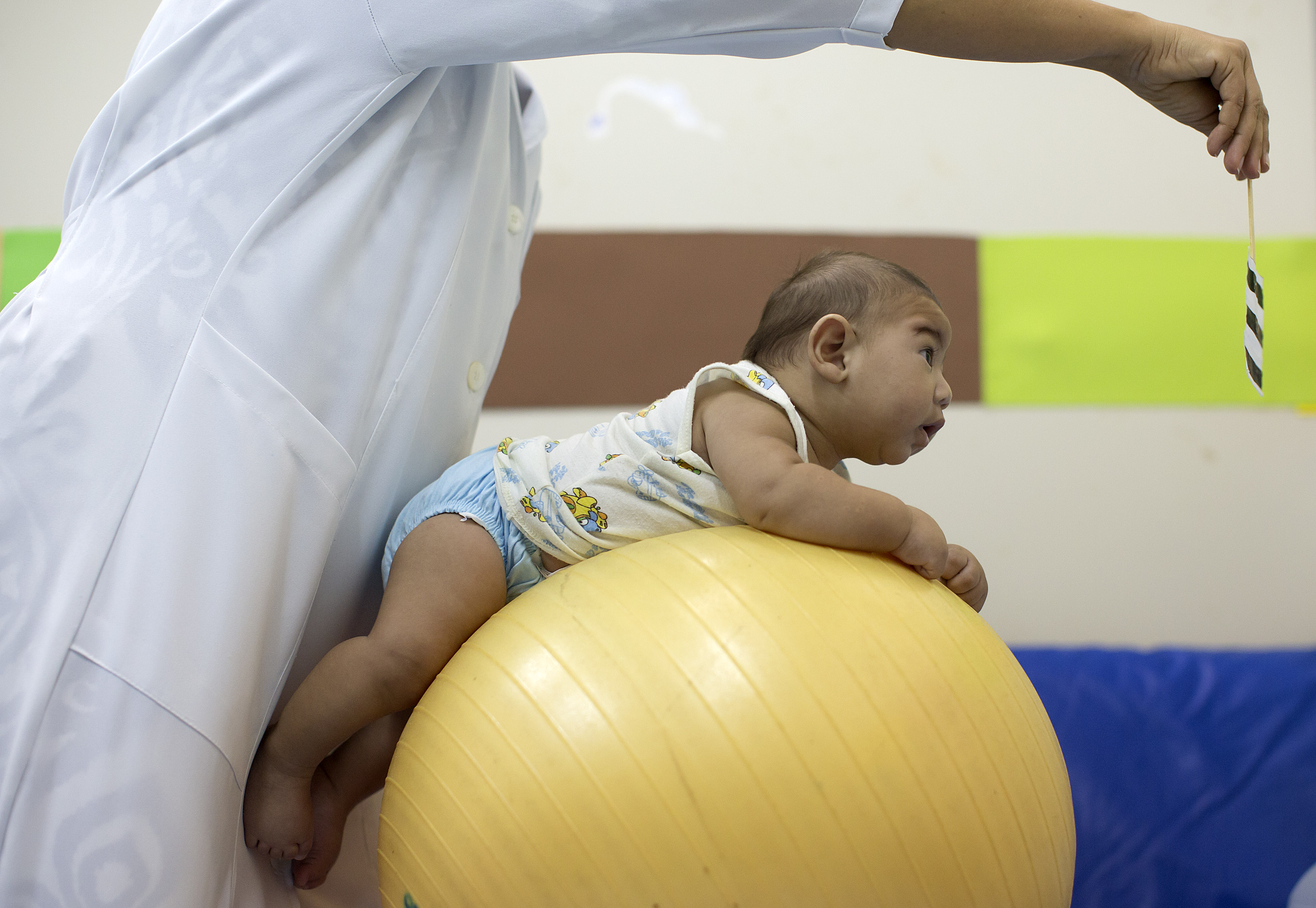An infant who was born with microcephaly undergoes physical therapy at a therapy treatment centre in Joao Pessoa, Brazil. Photo: AP
