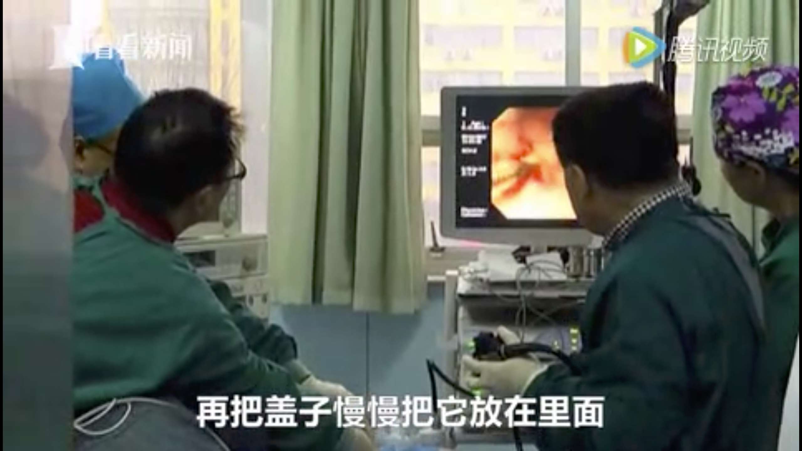 Dr Ju Weiping, left, watches a monitor showing the patient’s stomach as he removes a swallowed bottle cap. Photo: Qq.com
