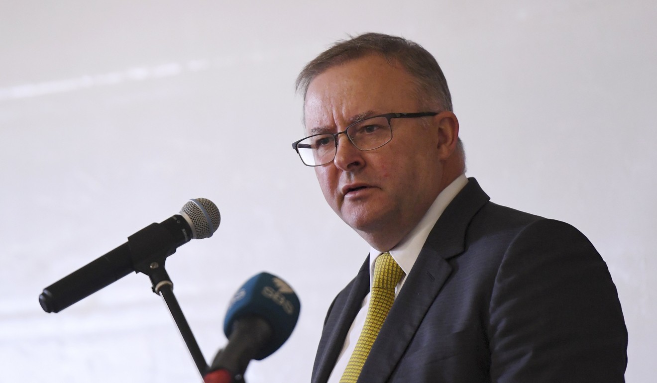 Federal Labor MP Anthony Albanese. Photo: EPA