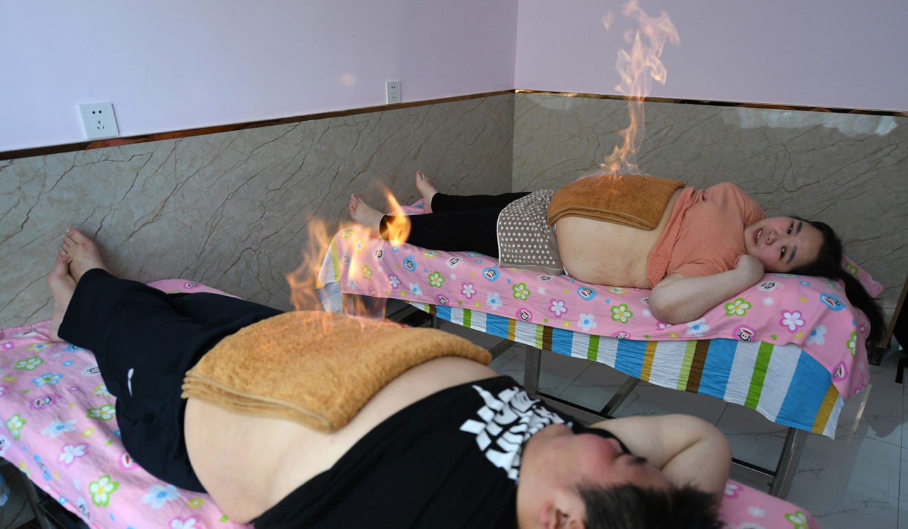 The couple undergo a traditional Chinese heat treatment as part of their weight-loss programme. Photo: CNA