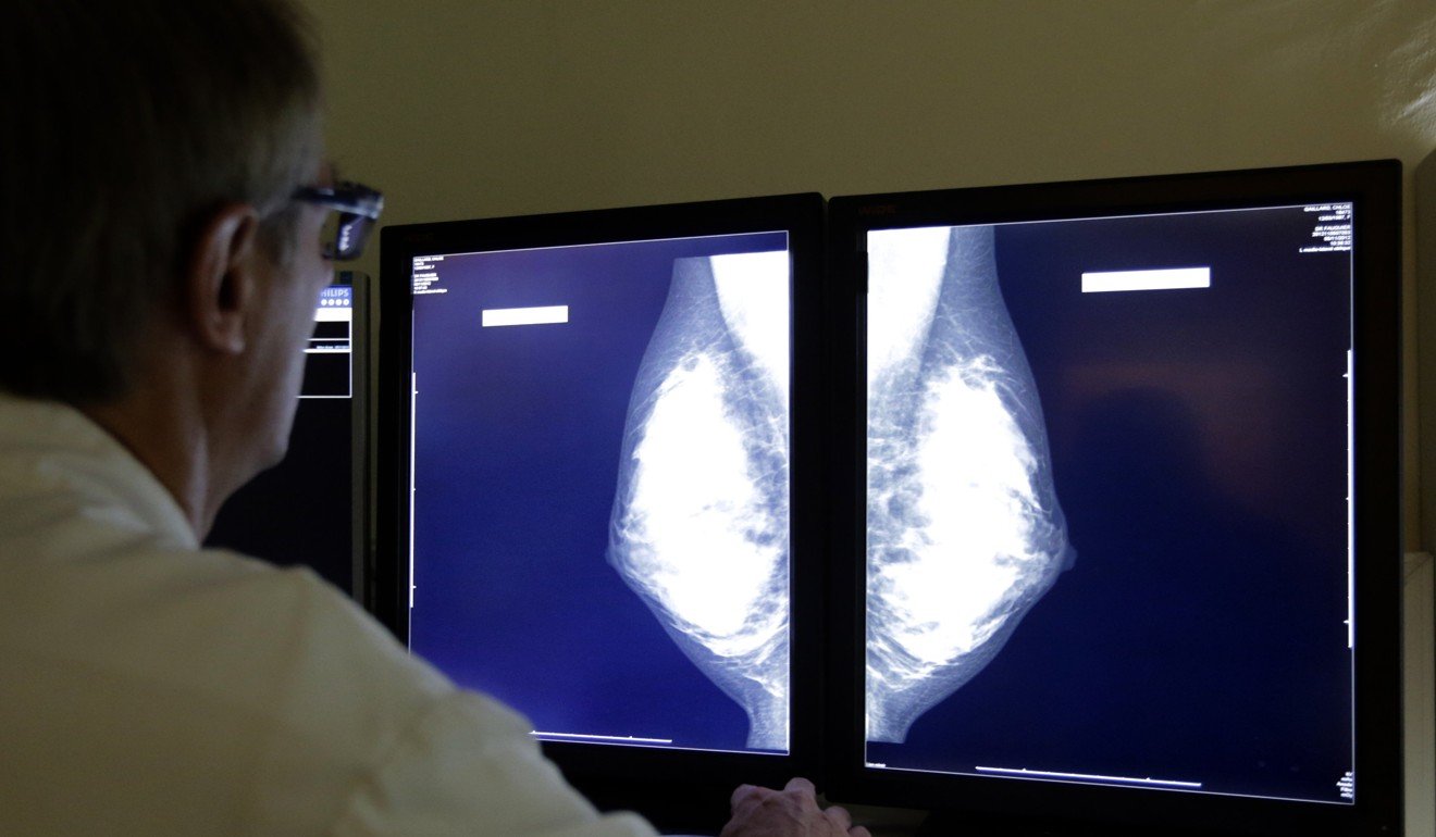 Advances in AI recognition technology mean radiologists could find themselves unemployed, according to some experts. Photo: Reuters