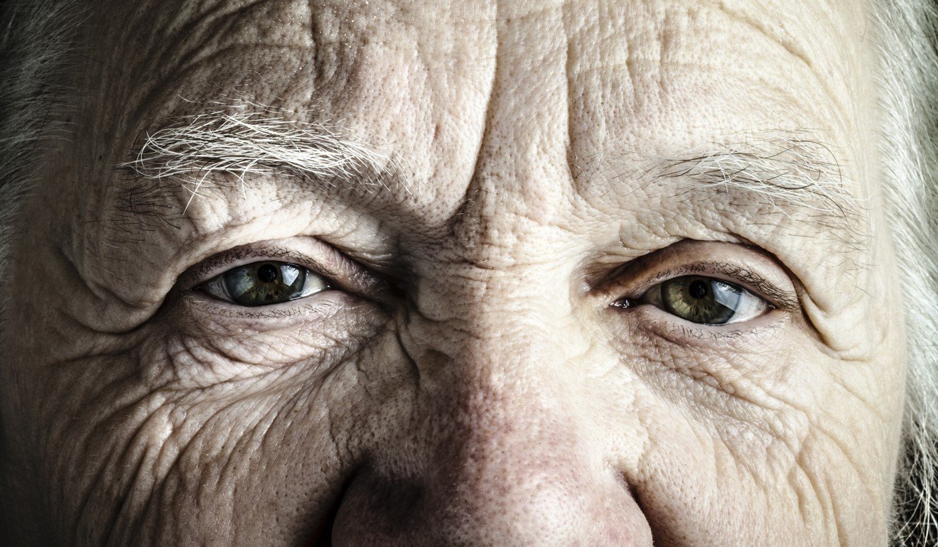 Most visual problems occur in old age. Photo: Shutterstock