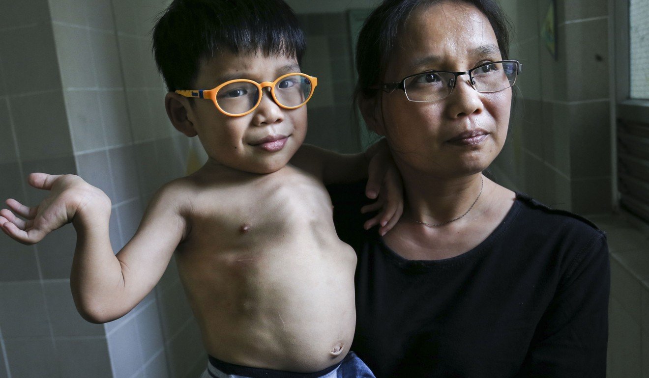 Hiu-chun was diagnosed with Mucopolysaccharidosis when he was three. Photo: Dickson Lee
