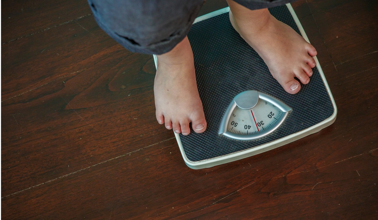 An overweight child weighs himself. Obesity has risen across the developed world in recent decades due to increased caloric intake and reduced physical activity. Photo: Shutterstock