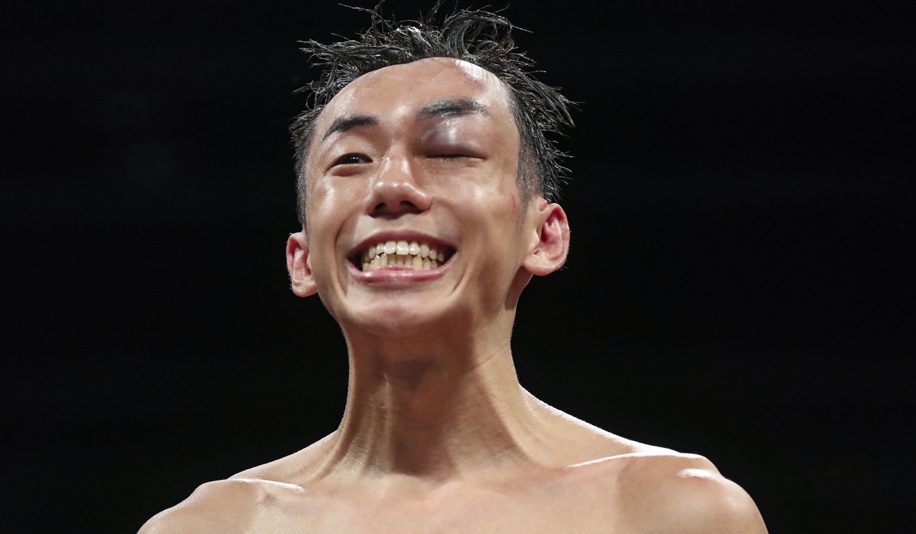 Rex Tso has fully recovered from his injuries sustained in his last fight against Japan’s Kohei Kono. Photo: Edward Wong