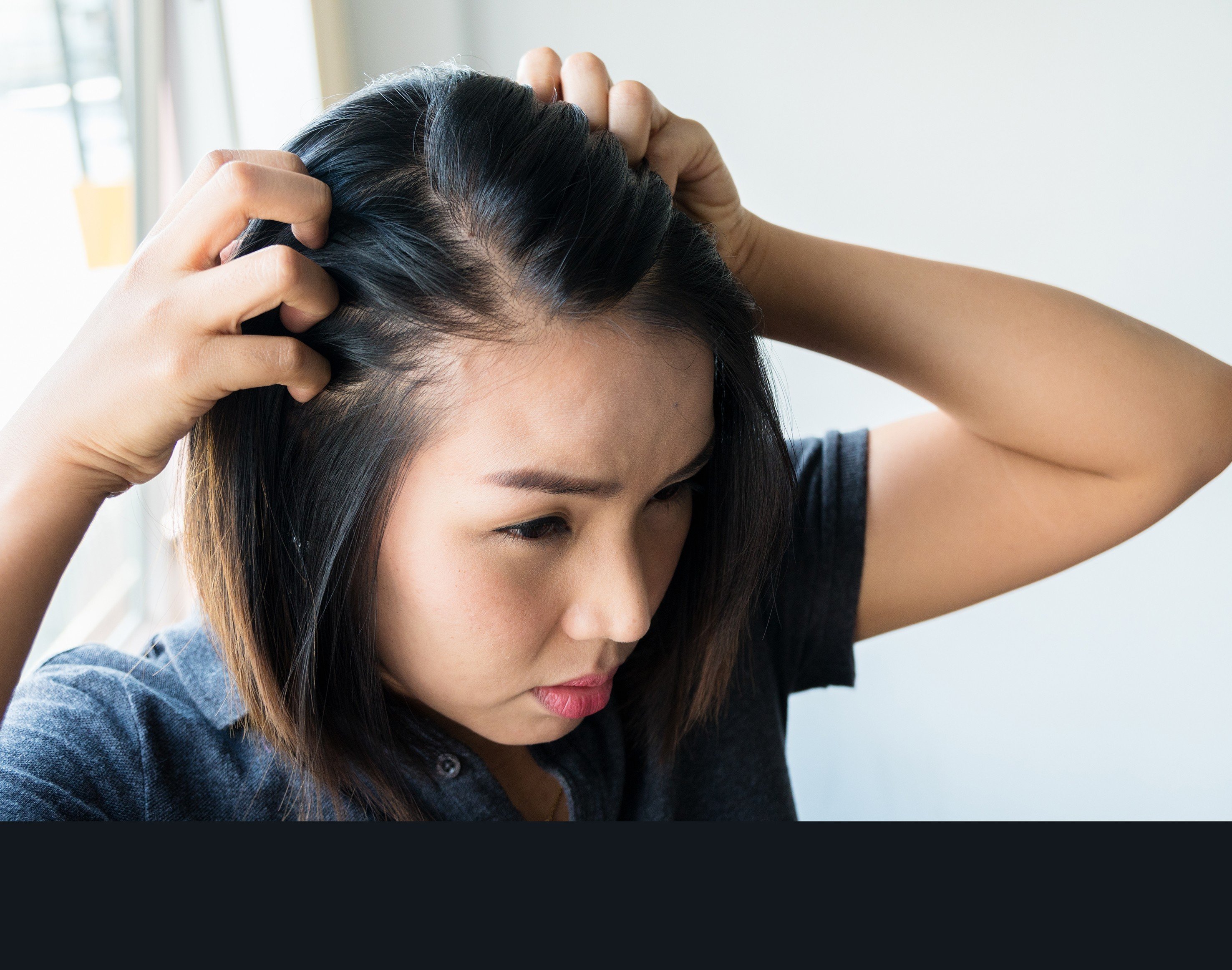 How stress and anxiety can cause hair loss issues