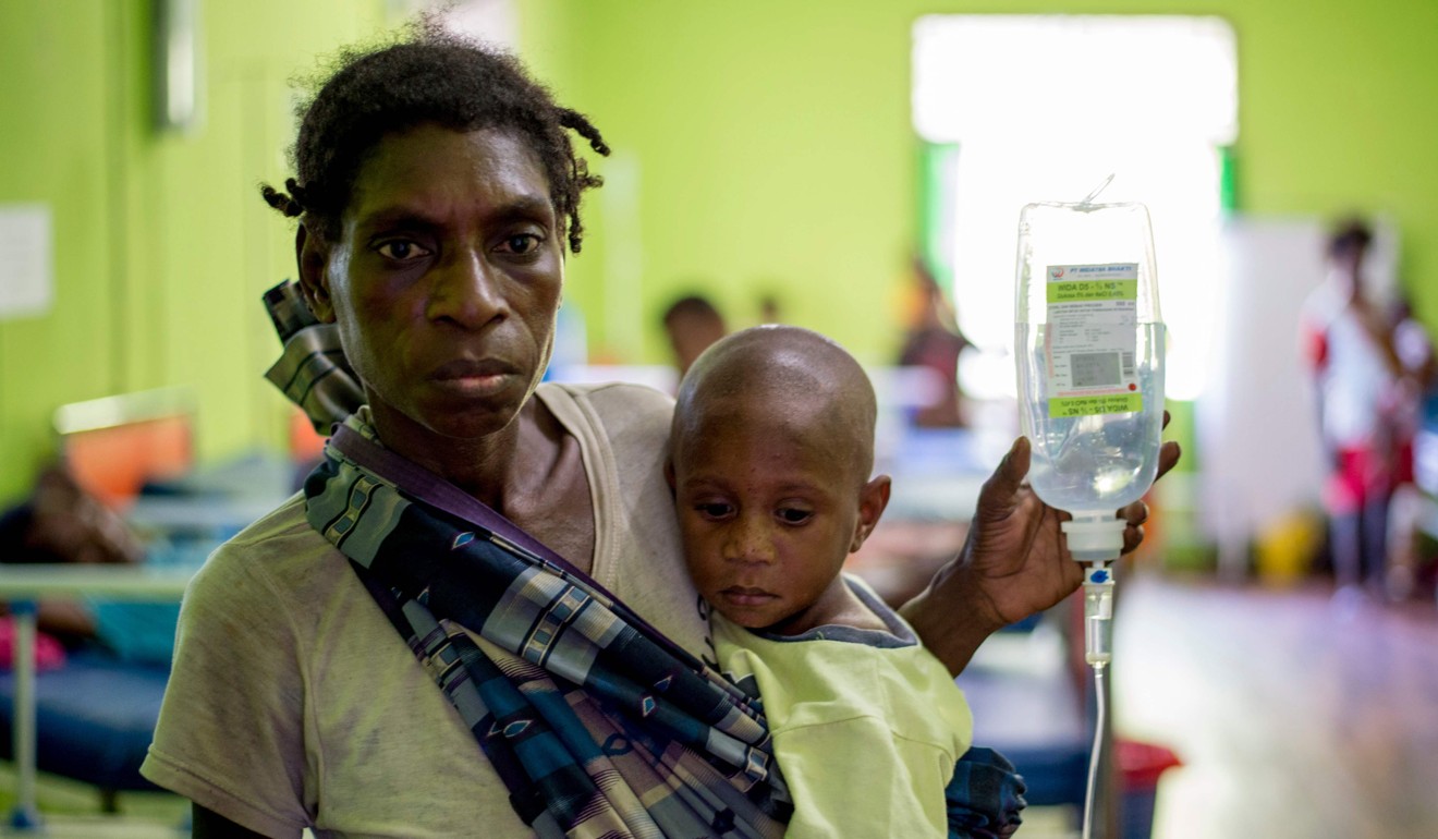 A Papuan woman carrying a drip looks on with her child at a local hospital. Photo: AFP