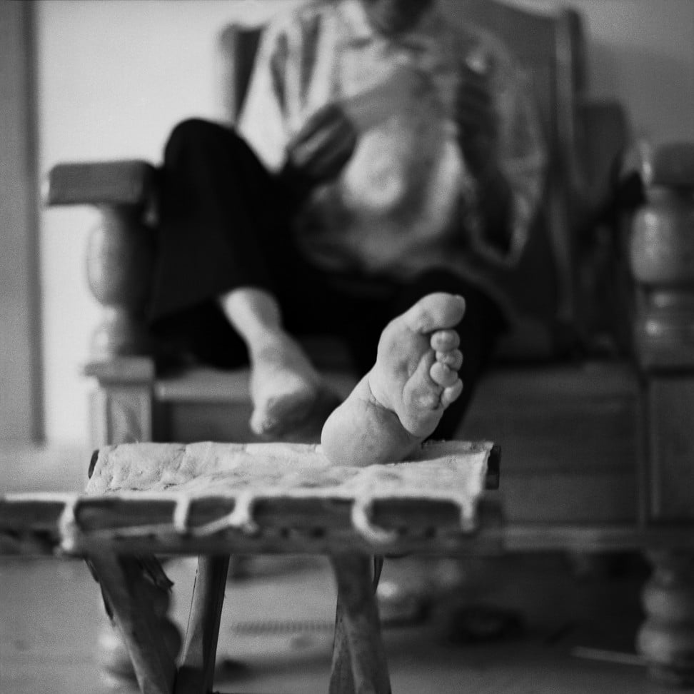 Foot Binding Photos Of Chinese Women The Tiny Shoes They Wore And X