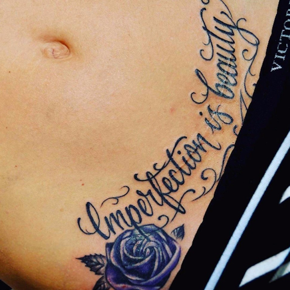 A caesarean scar is covered by a tattoo. Photo: SCMP