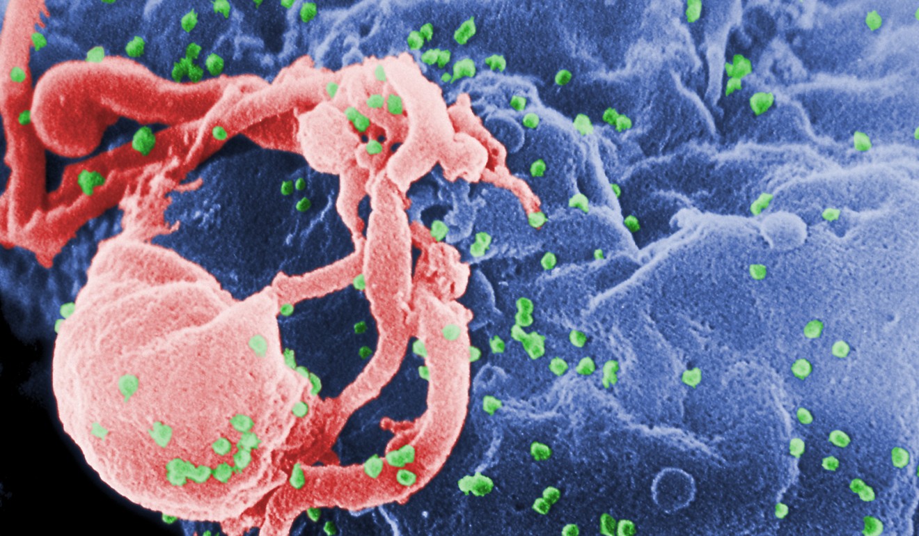 A close up of the Human Immunodeficiency Virus. Photo: AFP