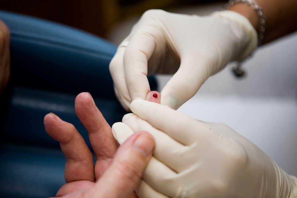 A simple blood test can detect life-threatening sepsis. Photo: Alamy