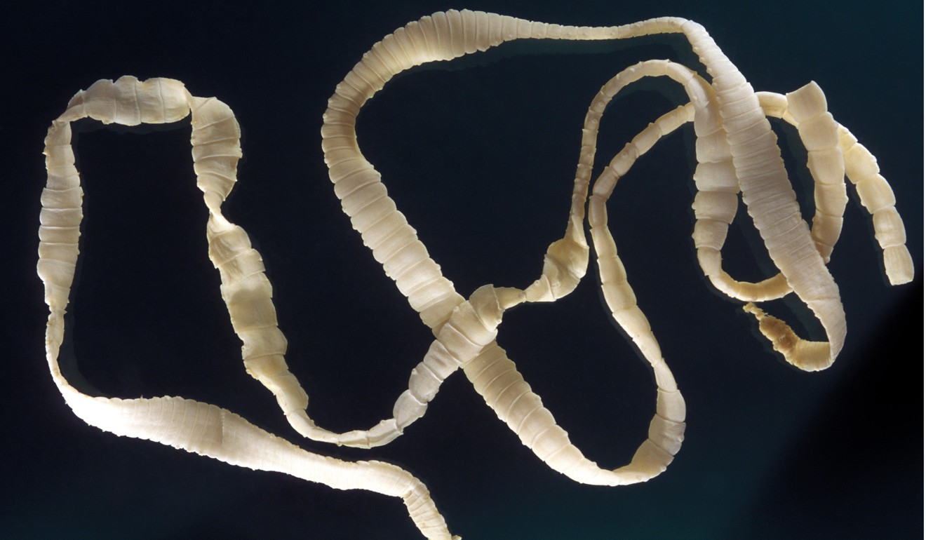 How Parasitic Worms Could Be Used Against Multiple Sclerosis And Other