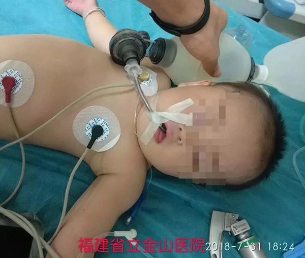 The one-year-old was revived with CPR and is being treated in intensive care. Photo: Changanhome.com