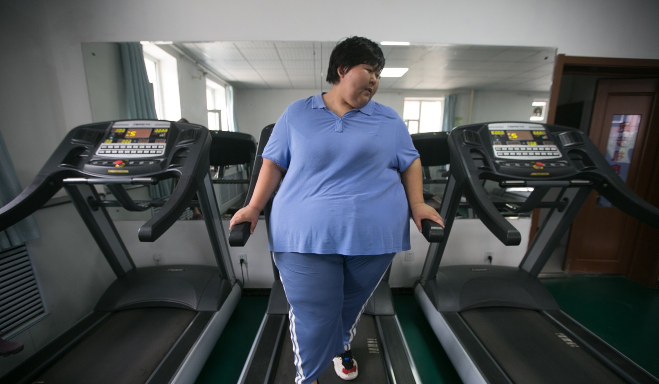 Guo Chengyan has dropped 30kg since entering a hospital weight loss programme in Changchun, Jilin province. Photo: China Foto Press