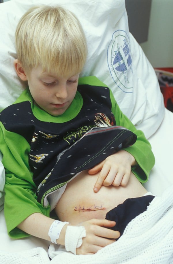 A boy lying in bed after his appendix has been removed. Photo: Alamy