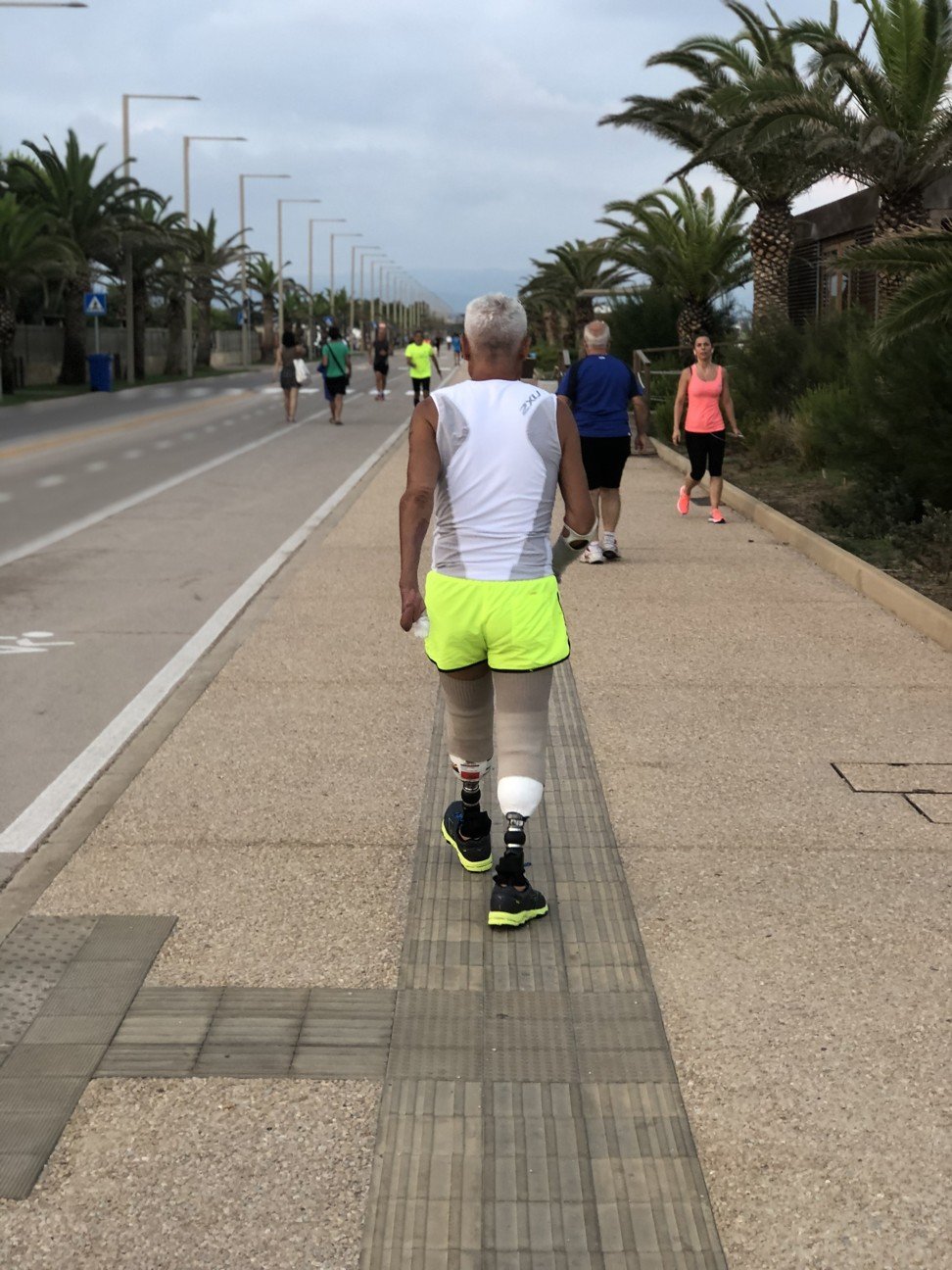 Zanda walking on his prosthetic legs this month. He aims to start running again in September. Photo: Lise Floris