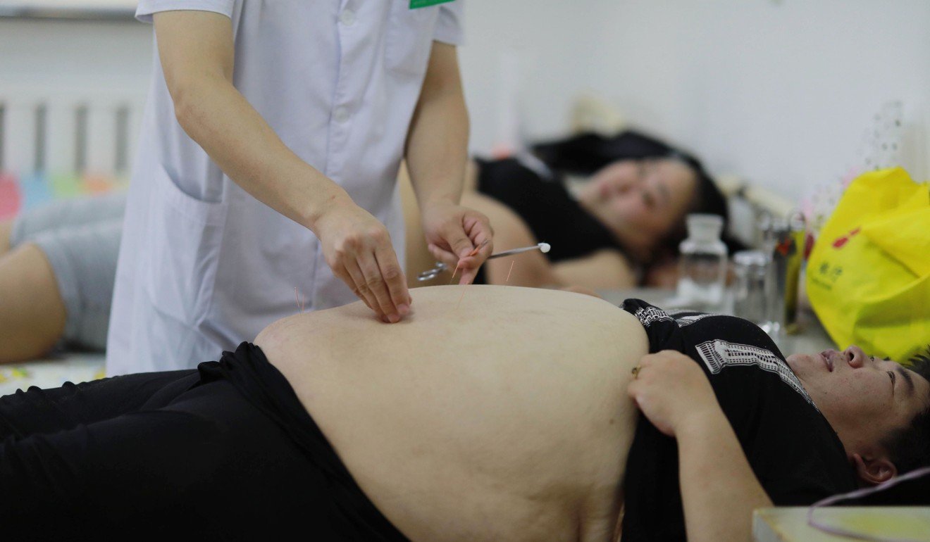 An overweight Chinese woman receives acupuncture treatment at a weight loss clinic in Changchun, Jilin province. Photo: AFP