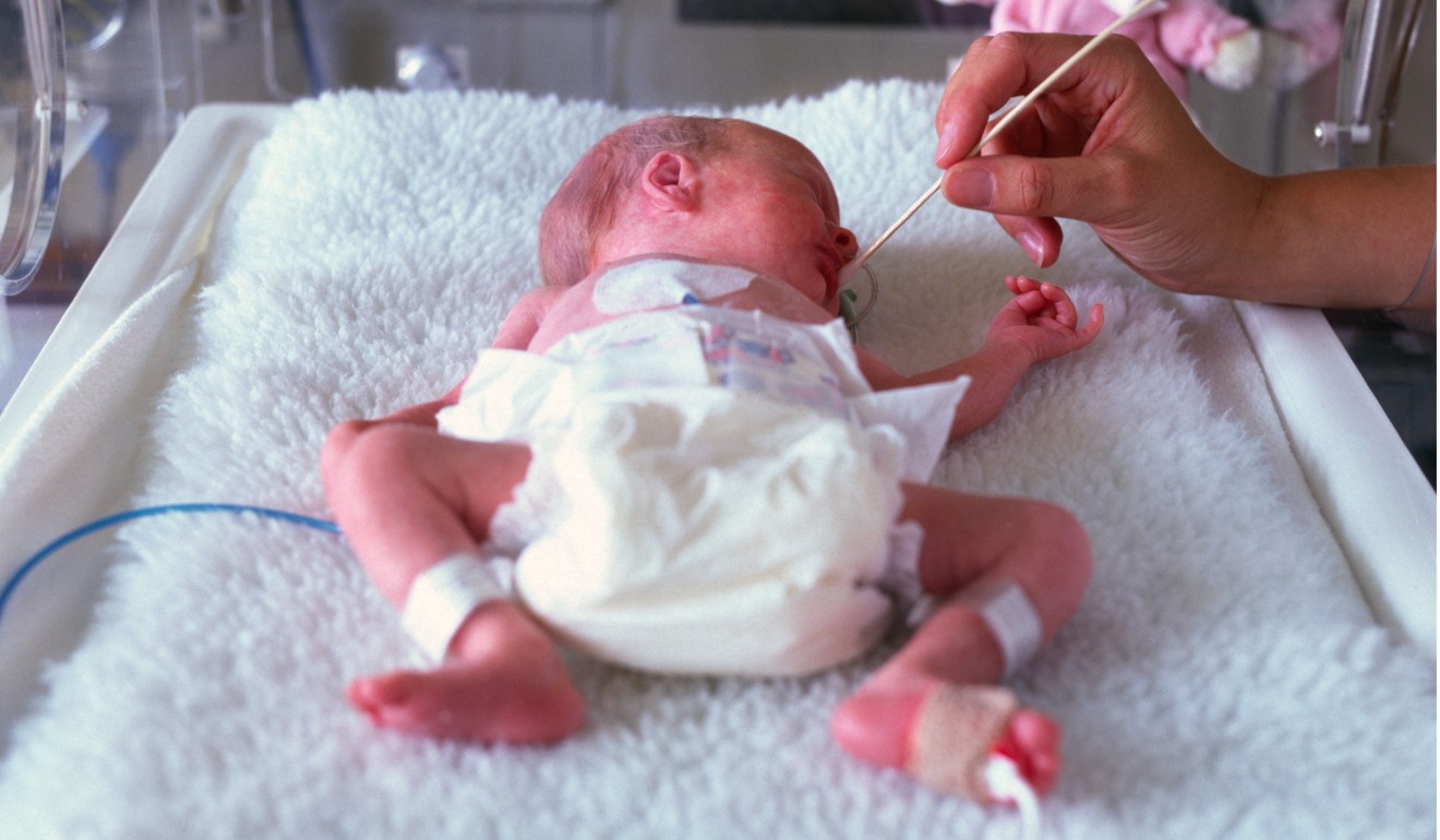 An underweight baby in an incubator. Researchers found that children born to fathers 45 or older were on average 20 grams (0.7 ounces) lighter, and had a 14 per cent higher risk of low birthweight than infants born to younger dads. Photo: Alamy