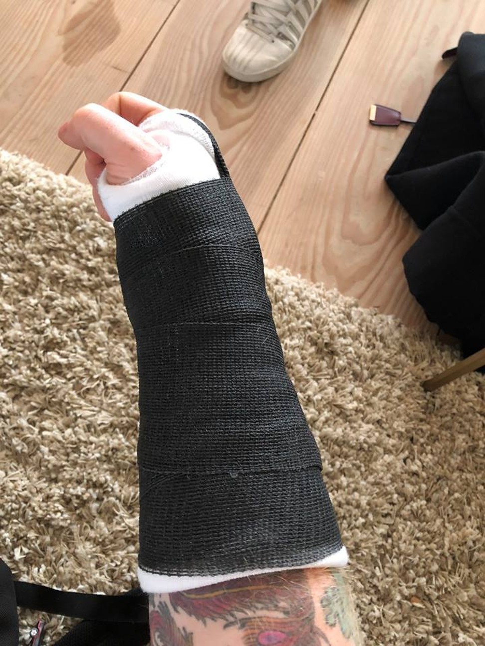Ed Sheeran’s post showing his arm in a cast in October 2017.