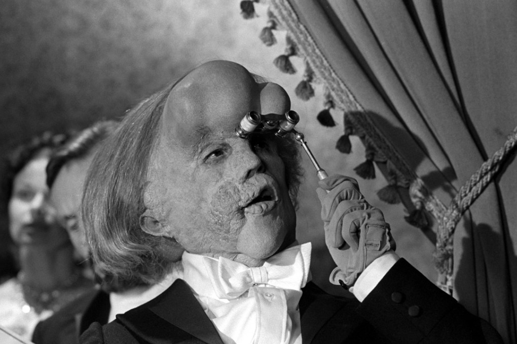Flashback: The Elephant Man, David Lynch's most conventional film, takes a compassionate look at the life of Joseph Merrick | South China Morning Post