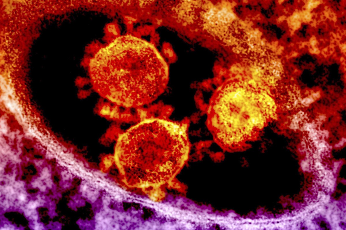 How To Avoid The Mers Virus According To Health Officials South How To Avoid The Mers Virus According To Health Officials South