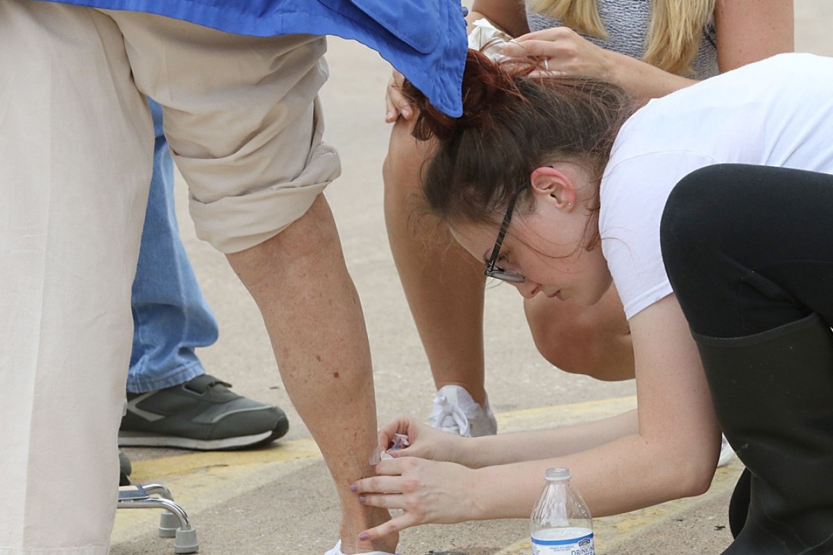 Southern Us Plagued By Hookworms A Disease More Common In Africa And Asia South China Morning Post