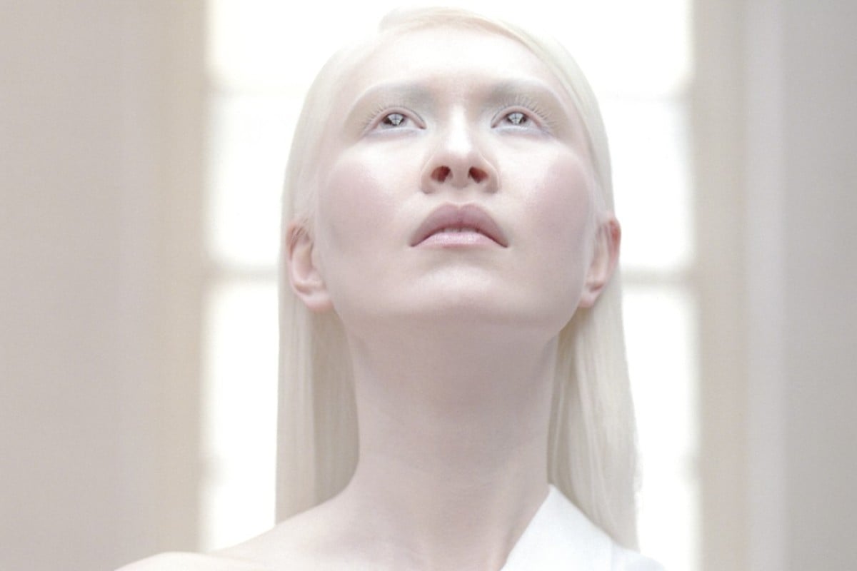 World’s first albino model Connie Chiu on growing up in Kowloon and