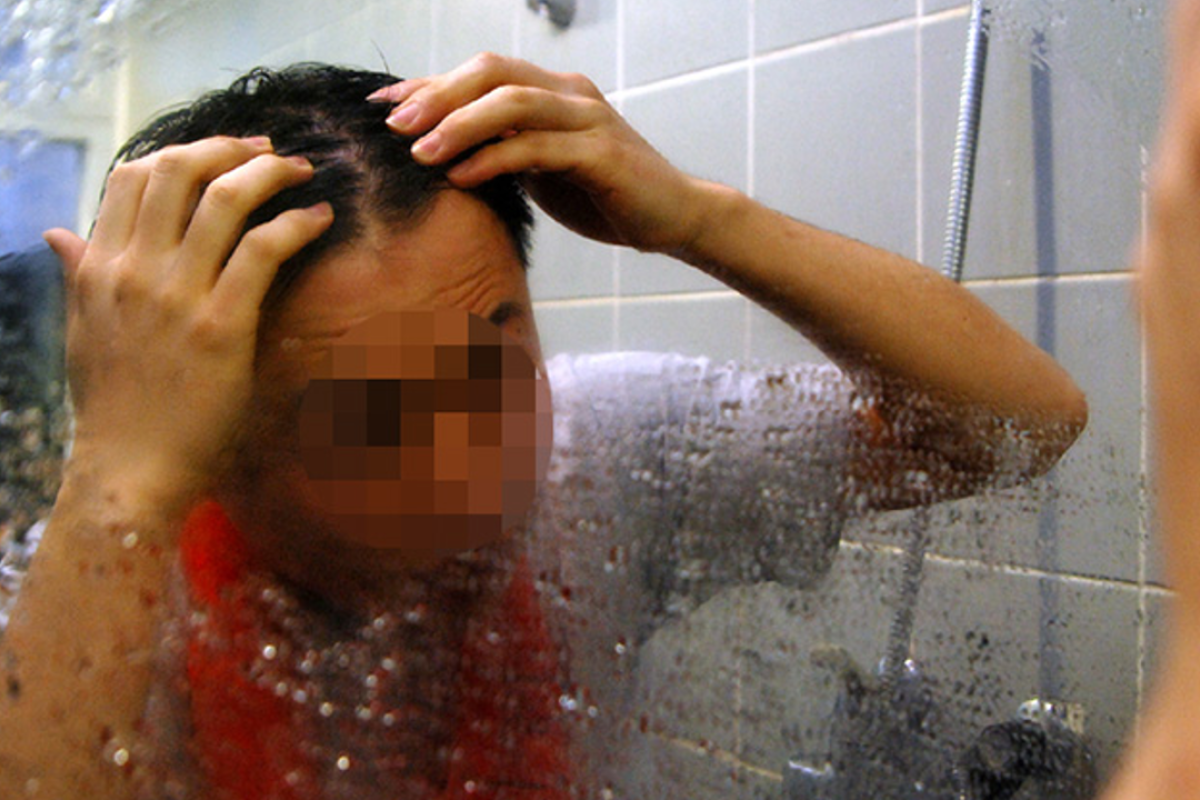 Korean Scientists Develop Biochemical Breakthrough For Hair Loss South China Morning Post