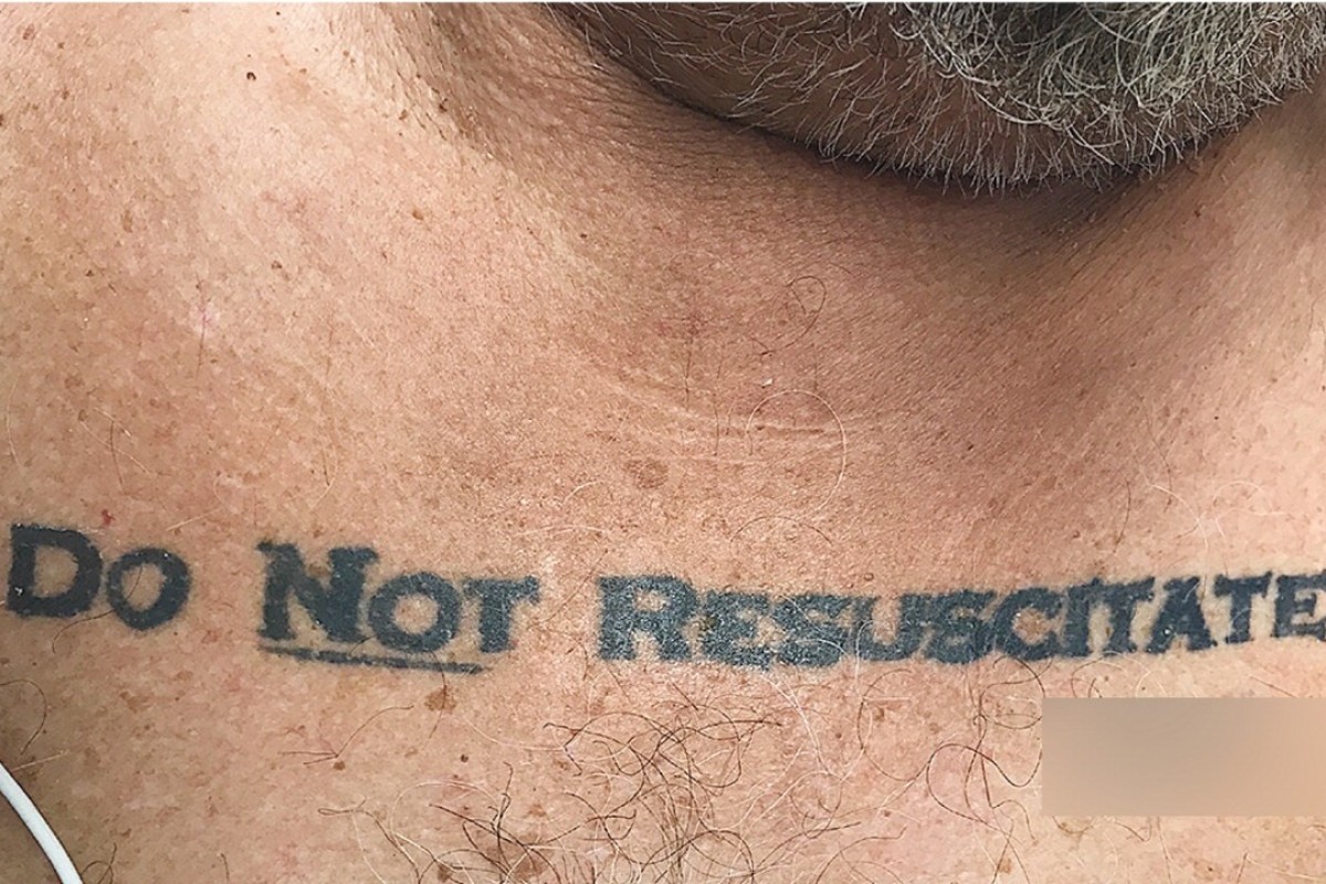 ‘Do not resuscitate’: unconscious patient’s tattoo thrust life-and