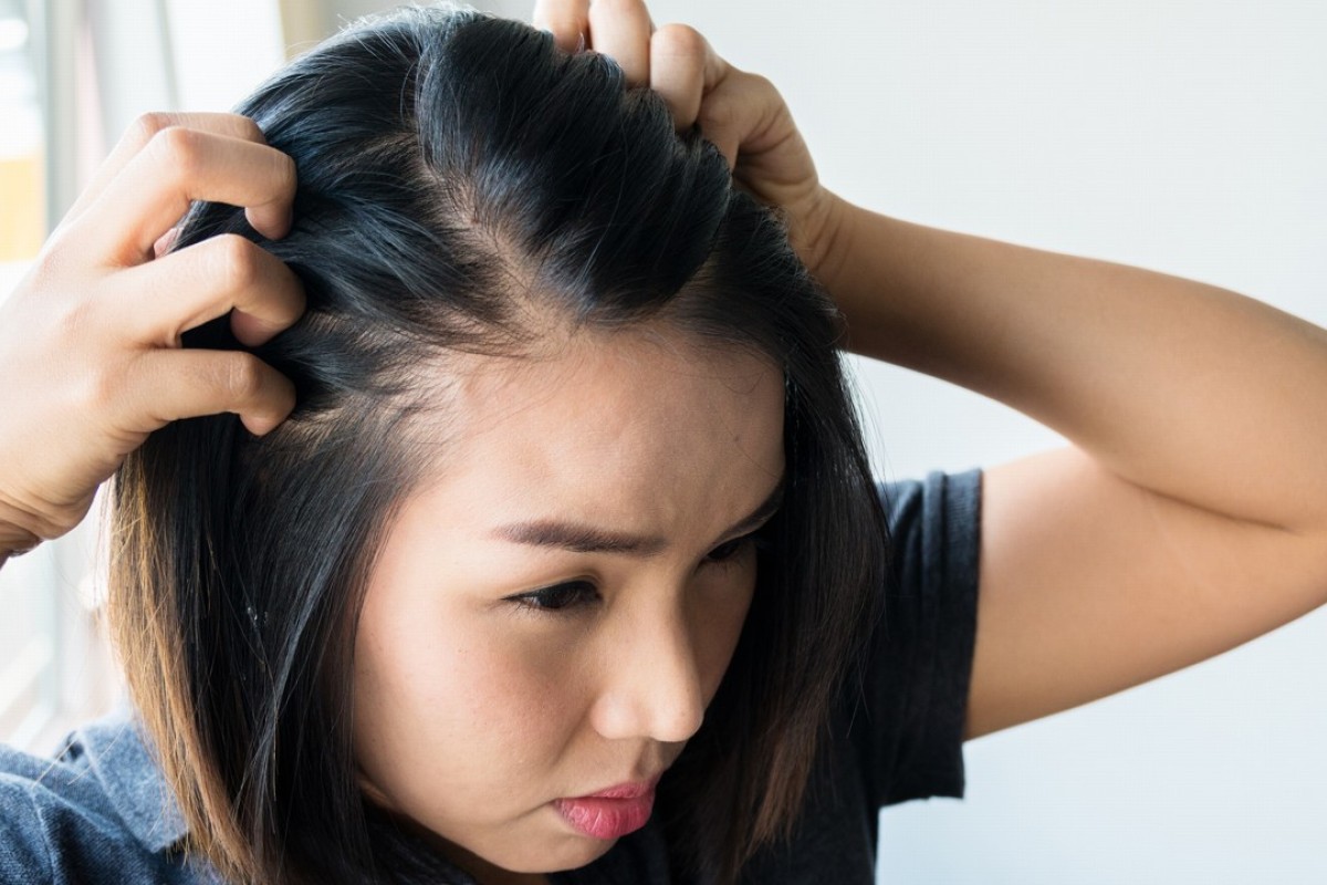 hair loss: its causes, how to head it off and where to look