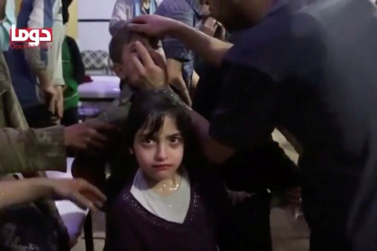 シリアのドゥーマで化学兵器が攻撃された容疑で少女が治療を受けた。 写真：ロイター