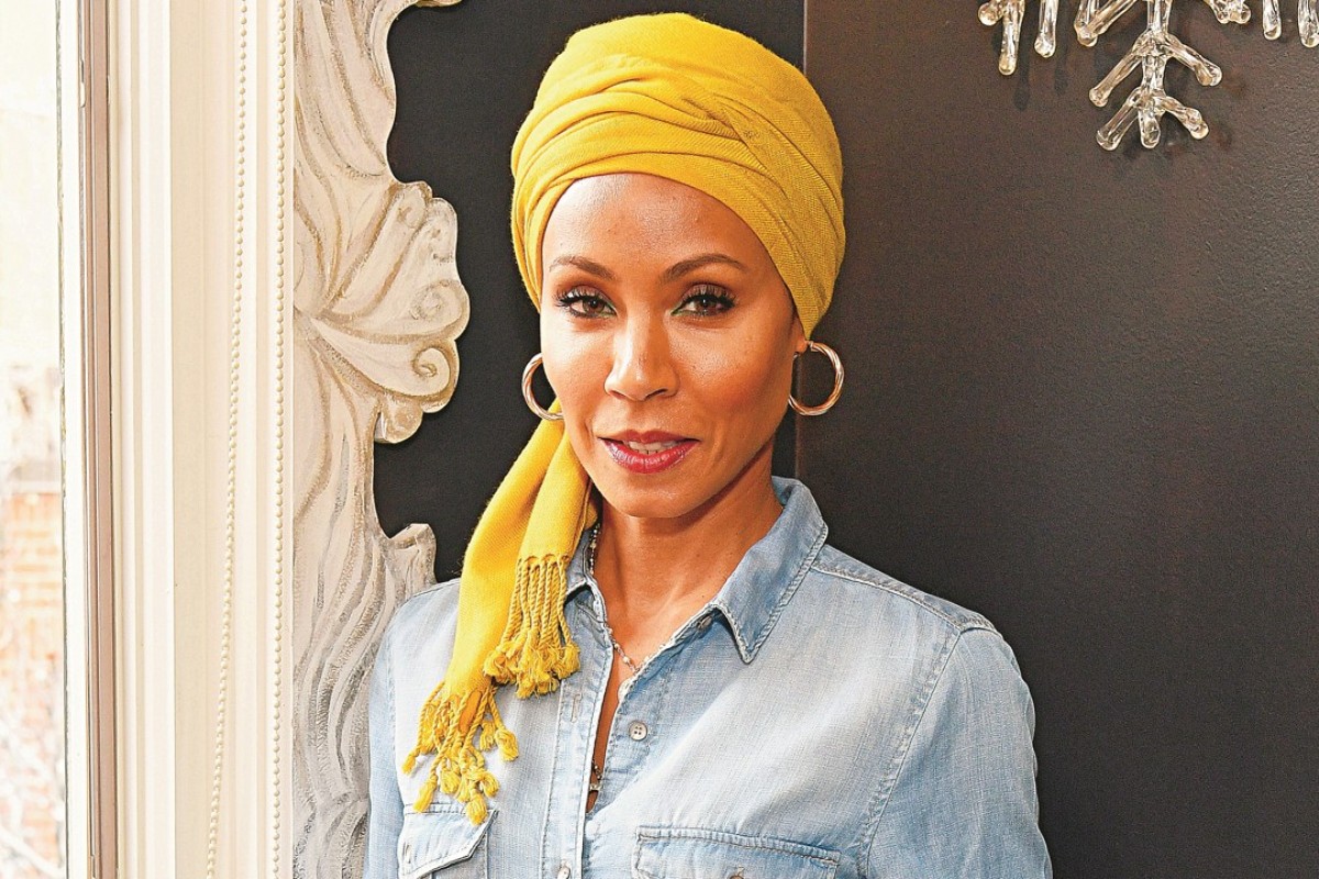 Womens Hair Loss How To Prevent And Treat It The Lifestyle