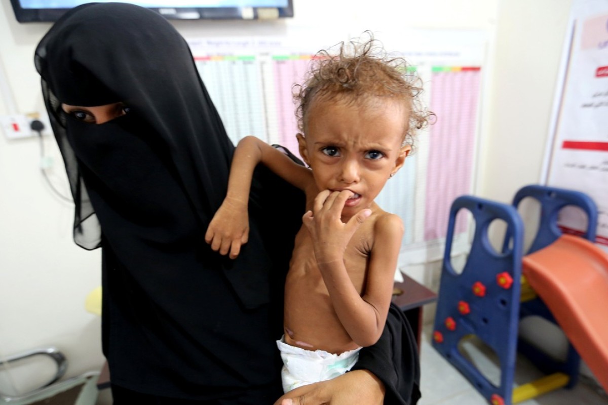 Image result for Stop abusive practices and suffering of Yemeni people