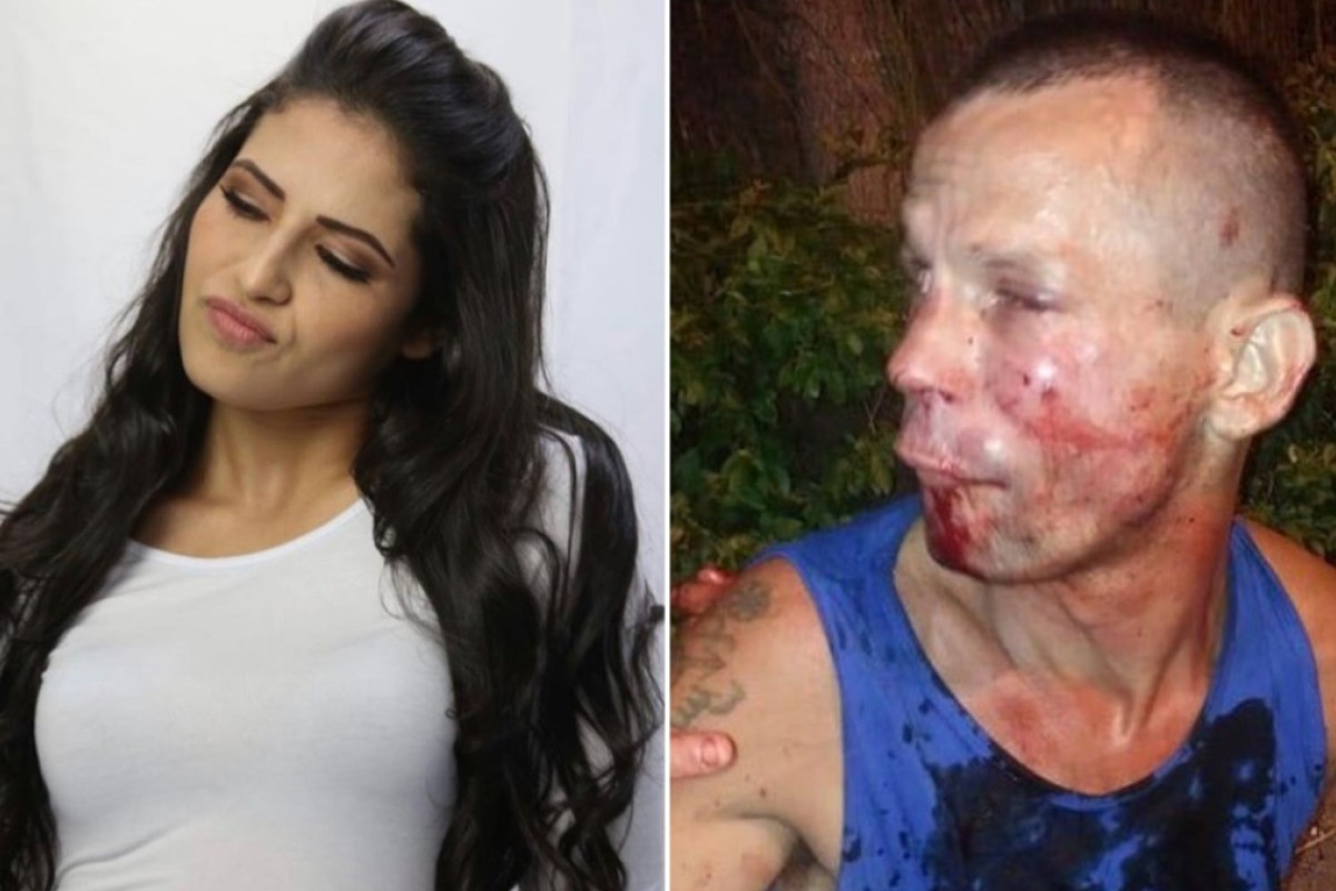 What Do They Put On Ufc Fighters Eyebrows Eyebrowshaper