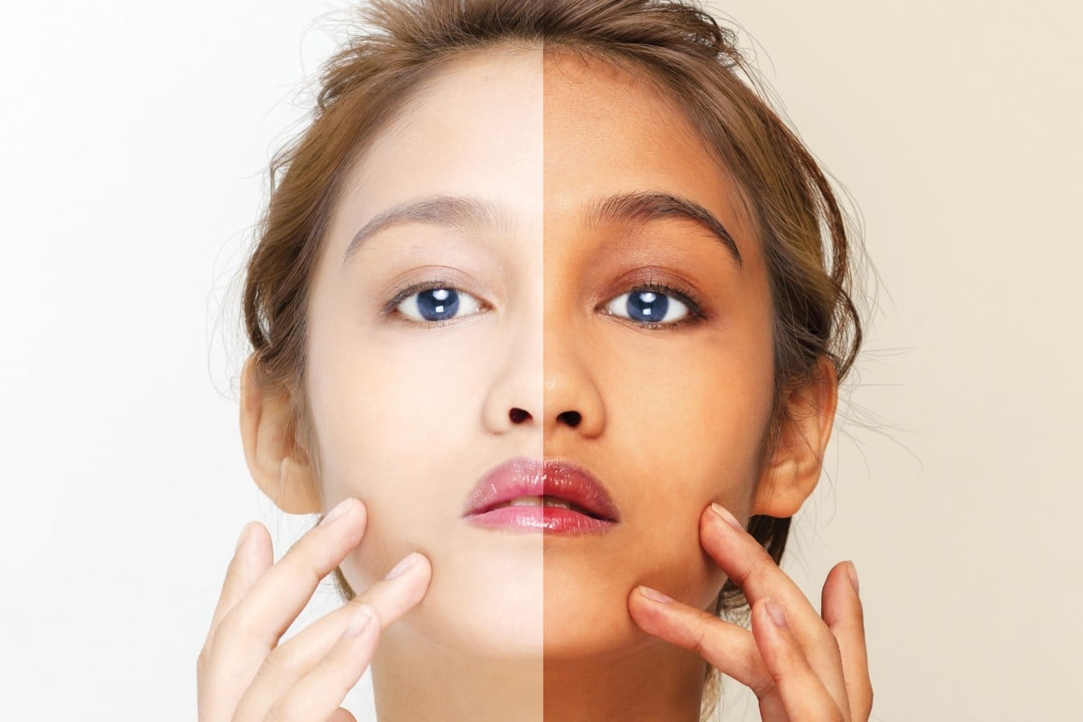 Asia S Addiction To Whiter Skin Runs Deep But The Backlash Has