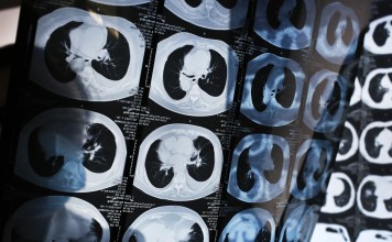 The iFlyTek Smart Doctor Assistant will study the medical cases and diagnosis skills of top doctors to help doctors in remote areas in China. Photo: AP