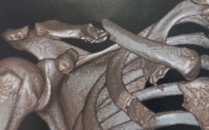 Umberto Rispoli's X-ray. Photo: Handout